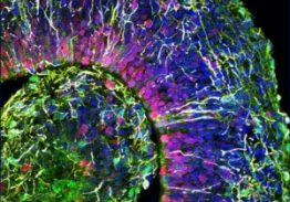 Lab-Grown Minibrains Show Activity Similar to Babies’ Brains